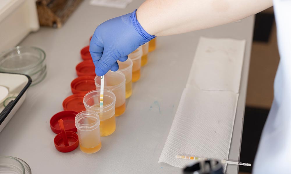Urine tests may detect Ativan for 3 to 6 days after your last dose