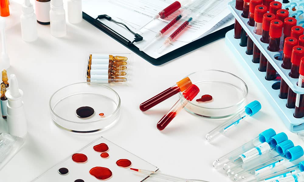 Blood tests are positive for about 24 hours after the last dose of codeine