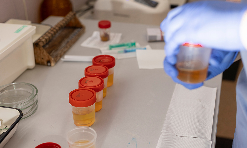 Fentanyl showing up for about 24–72 hours in urine