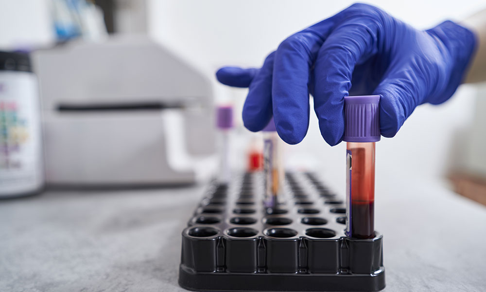 Blood tests will only identify Dilaudid for approximately 24 hours after ingestion