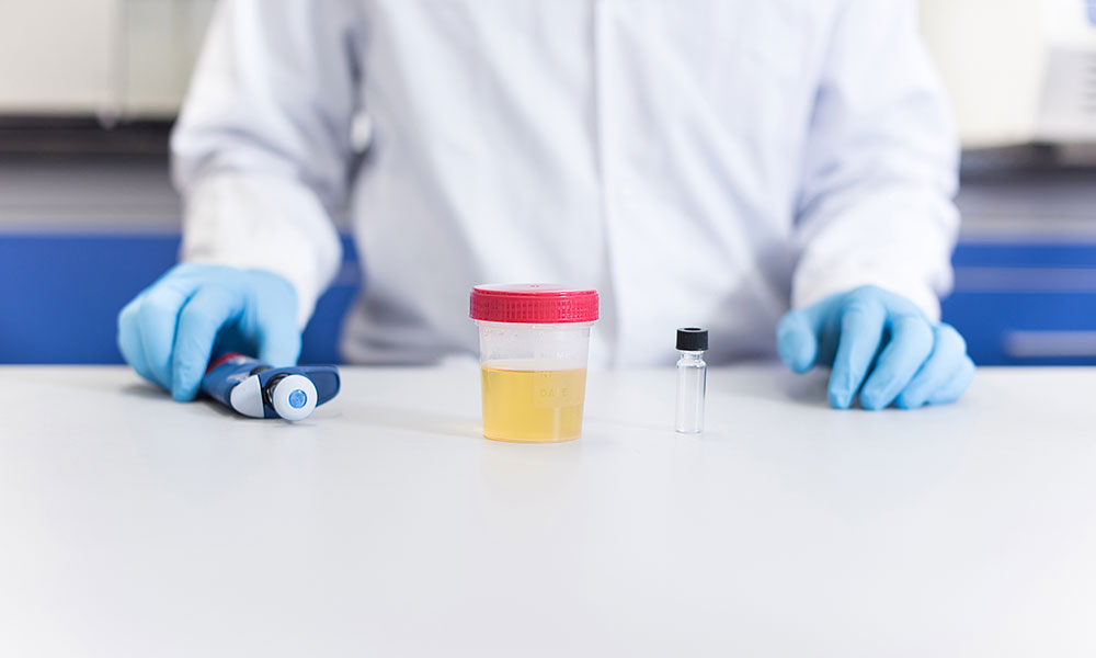 Percocet stays in a person’s urine for about 48–96 hours