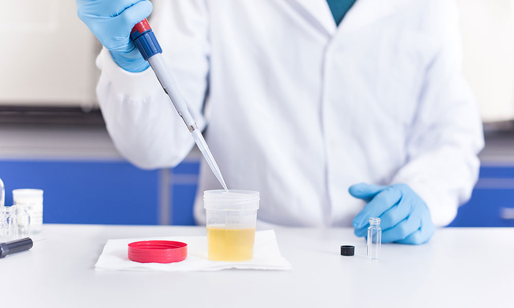 Urine-based testing is the most common form of testing