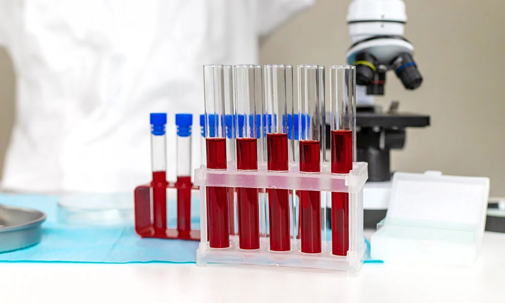 Blood testing normally identifies a shorter window than urine testing