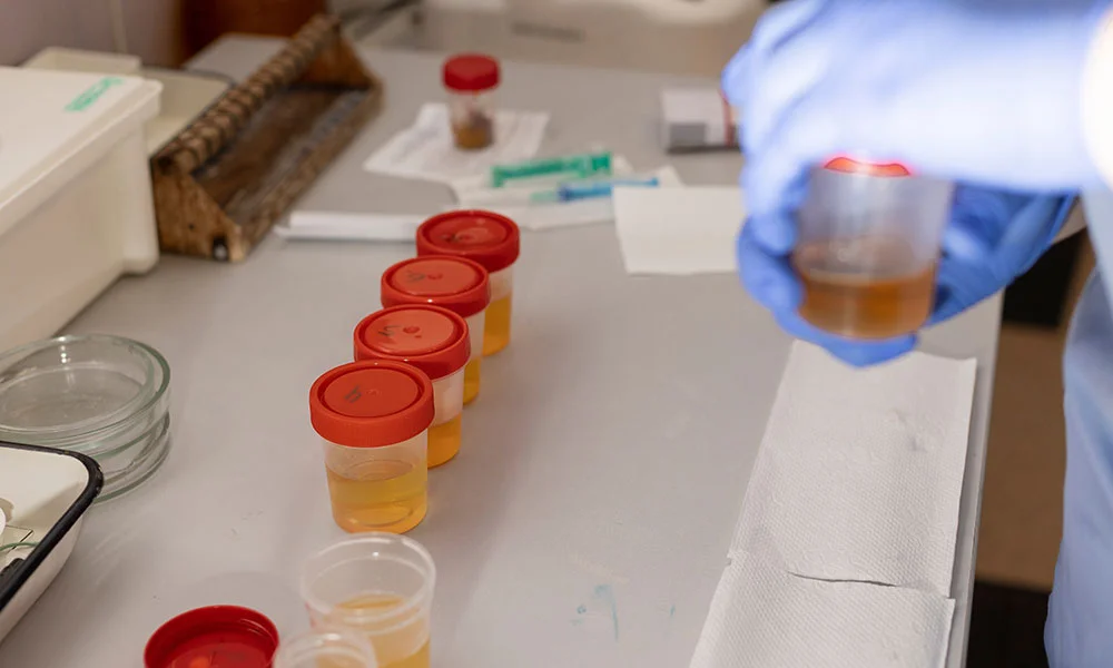Urine testing has ability to detect recent drug use over longer periods than blood or saliva